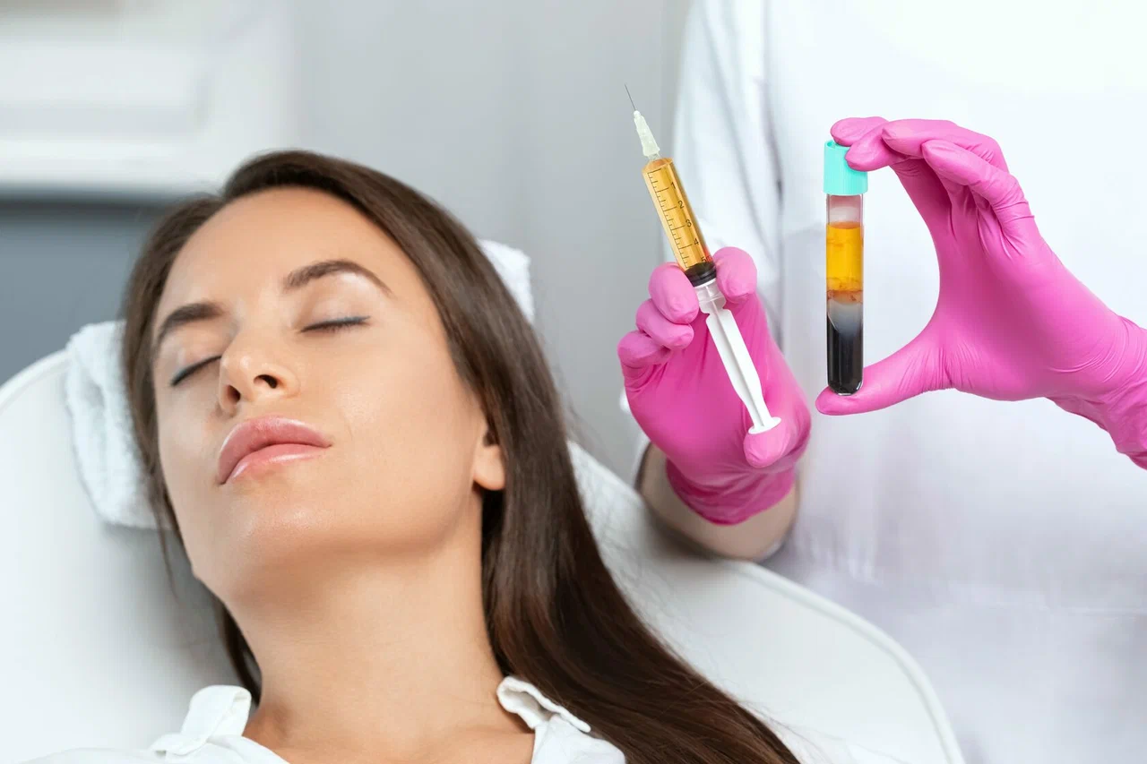 PRP Treatment in Knightsbridge, PRP facial therapy London