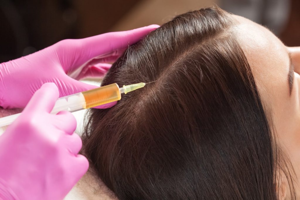 PRP hair restoration in Knightsbridge, Hair loss treatment in Knightsbridge