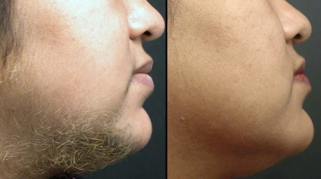 Levirgo Knightsbridge PCOS treatment consultation